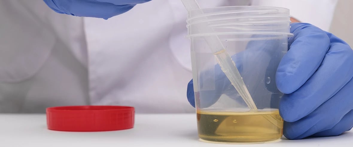 Research Update: The Effects of Alcohol on Postmortem Bladder Urine Volume