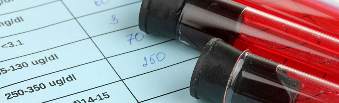 How Long Does Alcohol Stay in Your System, photo of blood test