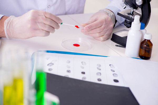 photo of lab dish, forensic toxicology